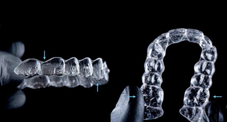 Sistemas de forças e função dos attachments na biomecânica dos alinhadores